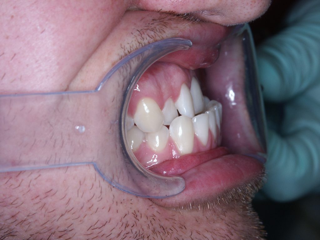 Malocclusioni scheletriche