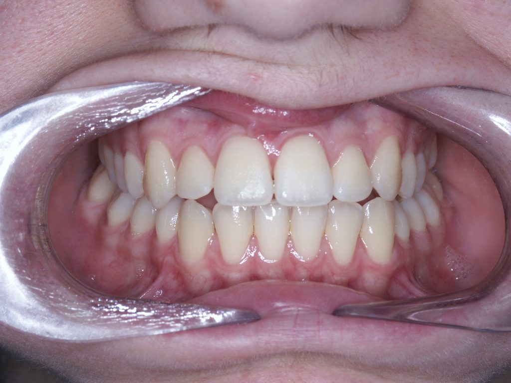 Malocclusioni scheletriche