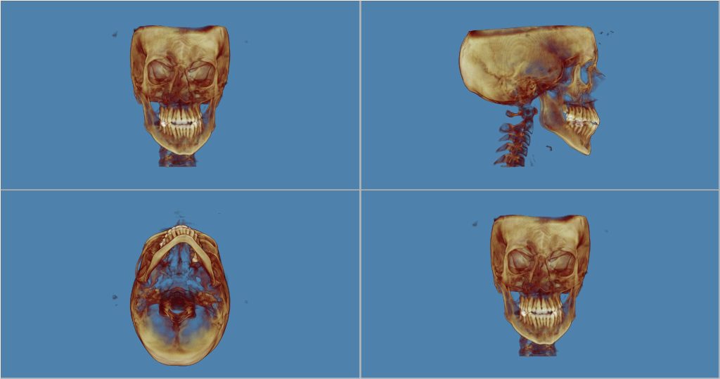 Radiografie 3D